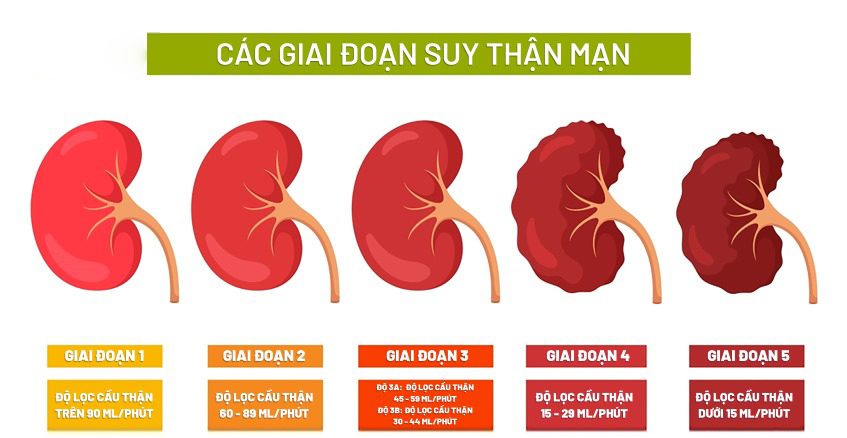 Các giai đoạn của bệnh thận mạn